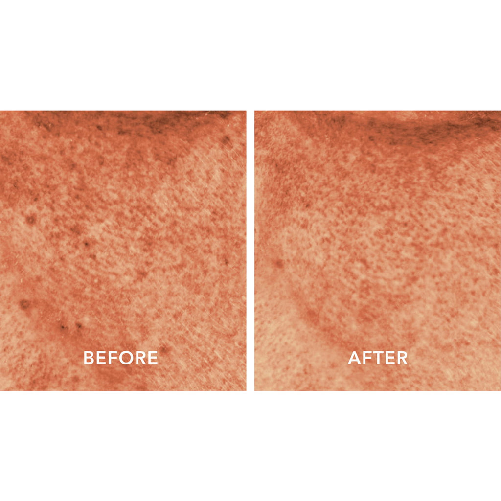 Blanc Peony Face Serum Dark Spot Corrector